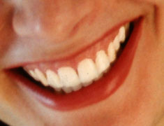 Schöne Zähne
